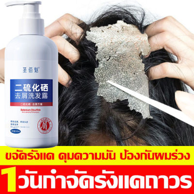 💥1ขวดแก้ปัญหาศีรษะหลายอย่าง💥 SBM แชมพูขจัดรังแค 300ML ยาสระผมรังแค สำหรับคันหนังศีรษะโรคอักเสบรูขุมขนหนังศีรษะ เชื้อราบนศีรษะ แชมพูแก้เชื้อรา ลดรังแคฆ่าเชื้อแก้คัน ยาสระผมแก้เชื้อรา ยาสระผมสมุนไพร แชมพูแก้คันหัว แชมพูทำความสะอาดเส้นผม