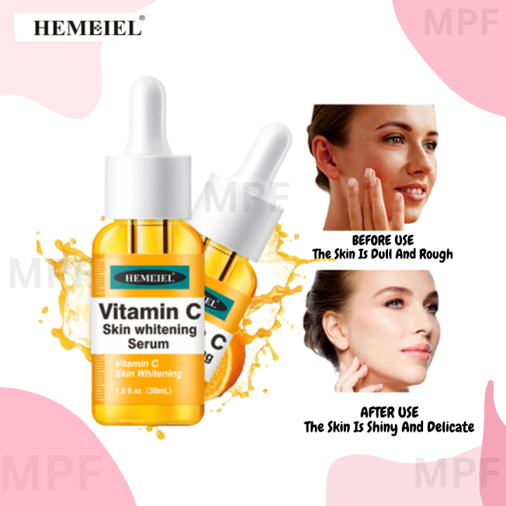 Original HEMEIEL Vitamin C Serum/Melasma and Pekas Remover/Niacinamide