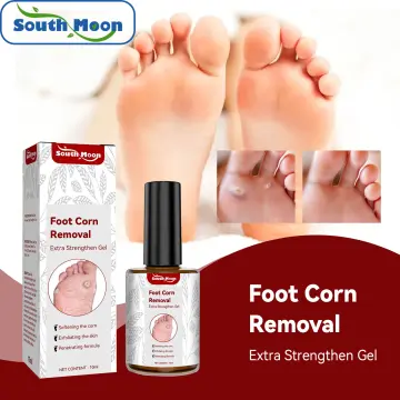 10ml Foot Toes Corn Callus Removal, Corn Callus Patch, Corn Cream