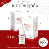 ของแท้ส่งไว! เซรั่มเลือดมังกรขนาดใหญ่ 30ml. เซรั่มลดสิว สูตรออร์แกนิค สิวยุบไว ฟื้นฟูผิวติดสาร Dragons Blood Acne Serum