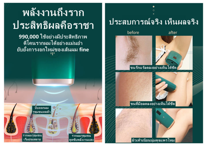 เครื่องเลเซอร์กําจัดขนถาวร-ipl-ทำหน้าใส-เครื่อง-iplเลเซอร์หน้าใส-กำจัดขน-ร้านขายสินค้าจากโรงงาน