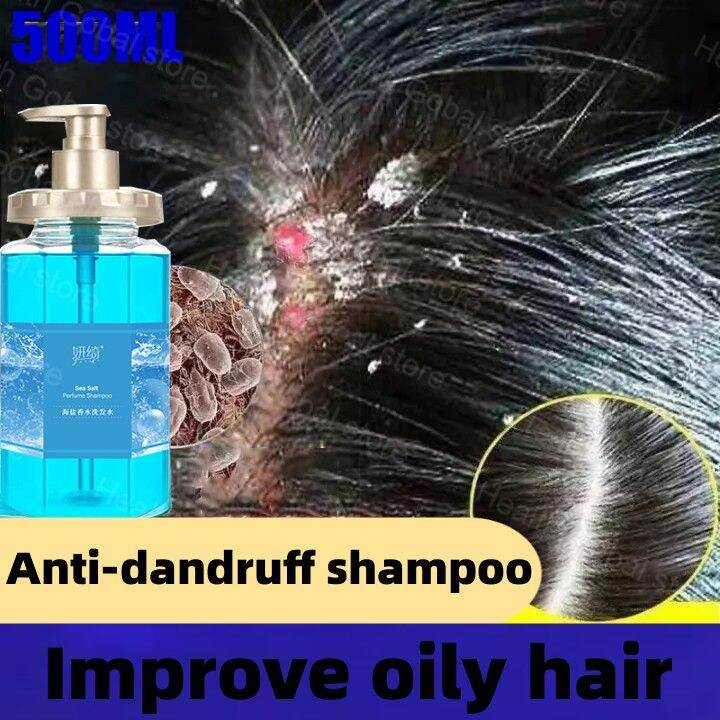 Hair shampoo, anti-dandruff shampoo Long-lasting fragrance, lots of ...