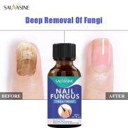 SAUVASINE Tinh Chất Phục Hồi Móng Serum Trị Nấm Móng Loại Bỏ Nấm Móng Chân