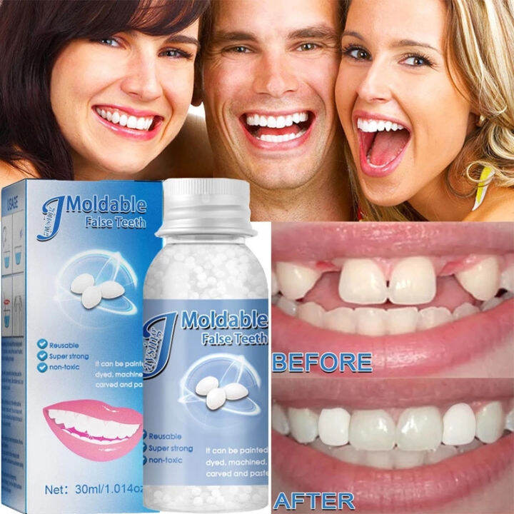False Teeth Filling Solid Glue Thermal Forming Denture Solid Tooth Gel