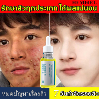 HEMEIEL เซรั่ม หน้า ใส/เจลแต้มสิว/ครีมกำจัดสิวเสี่ยน ทุกประเภท