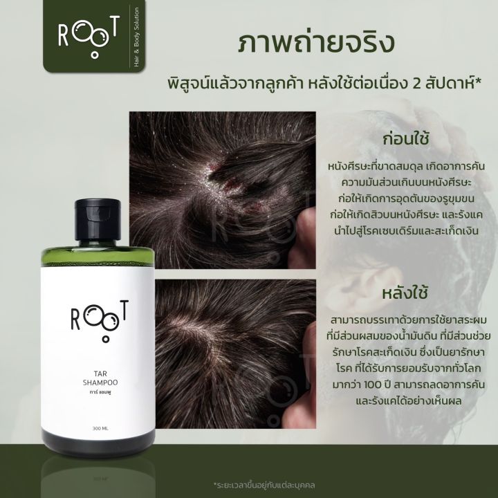 รูท-โปรดักส์-ทาร์-แชมพู-root-product-tar-shampoo-สูตรเข้มข้น-แชมพูน้ำมันดินขจัดรังแค-ลดอาการคันหนังศีรษะ-สะเก็ดเงิน