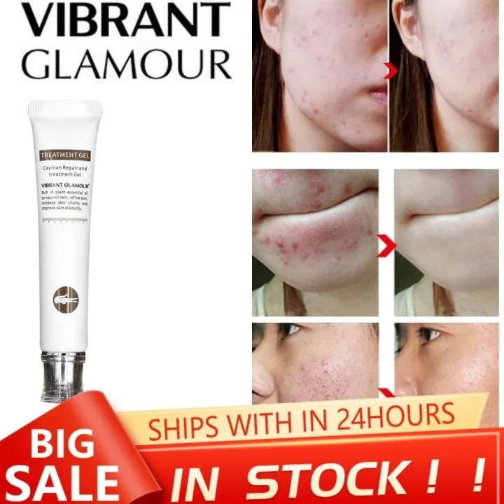 [Fast Delivery+ In Stock ]【VIBRANT GLAMOUR】Crocodile Repair Scar Gel ...