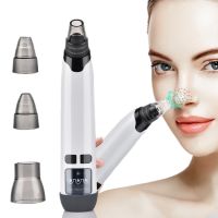 【CW】⊕✽  Facial Blackhead Remover Electric Acne Cleaner Spots Pore Machine