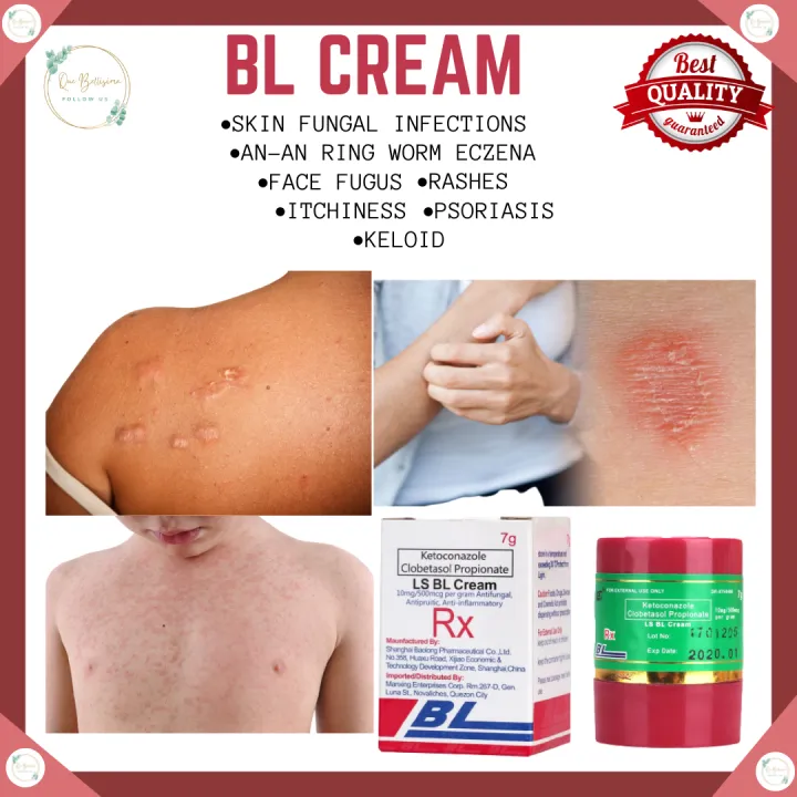 ORIGINAL LS BL Cream 7 grams Anti Fungal Cream 100 Safe treatment for