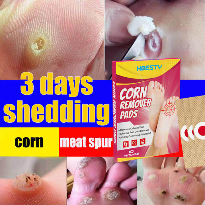 10PCS Feet Corns/ Warts Removal Patch Warts Remover Corns Foot Pads