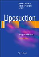 Liposuction : Principles and Practice, 2ed - ISBN : 9783662489031 - Meditext