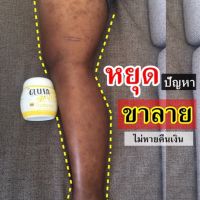 ?ครีมแก้ขาลาย ก้นลาย น้ำเหลืองไม่ดี? ขนาด 500 กรัมใช้ได้ 2 เดือน