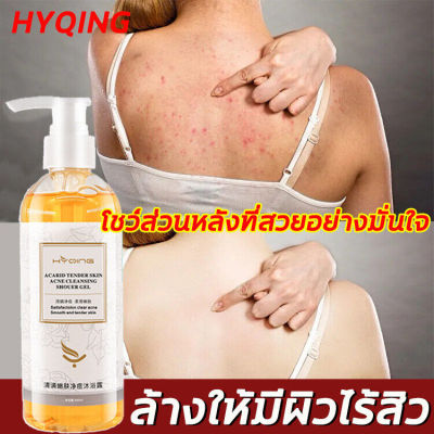 ล้างผิวสวยไร้ไรฝุ่น HYQING ครีมอาบน้ำ 260ML โฟมเยอะ อ่อนโยนไม่ระคายเคือง ยับยั้งไร ลบสิว ป้องกันผิวแห้งกร้าน ล้างให้มีผิวสวยใสไร้สิวออกมา บอกลาผิวหยาบกร้าน（เจลอาบน้ำ/ครีมอาบน้ำ/สบู่อาบน้ำครีมอาบน้ำ/โฟมเยอะ/เจลอาบน้ำซากุระ/โฟมโมเลกุลเล็ก）