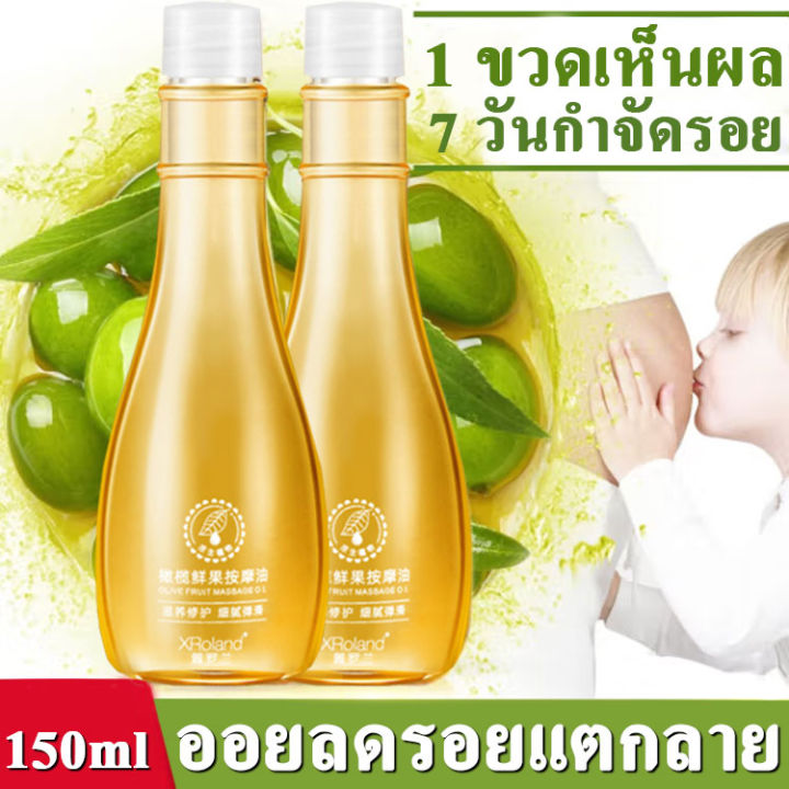 xroland-ครีมลดรอยแตก-150g-ขาแตกลาย-ลดรอยแตกลาย-เพิ่มความชุ่มชื้นให้แก่ผิว-กระชับผิวให้เรียบเนียน-ครีมทาแตกลาย-ครีมทารอยแตกขา-ครีมกันแตกลาย-ครีมทาท้องลาย-ครีมทารอยแตก-ครีมรอยเเตกลาย-ครีมทาหลังคลอด-ครีม