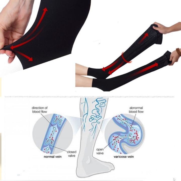 medical-compression-22-32mmhg-socks-varicose-veins-socks-elastic-nursing-pressure-stockings-sleep-feet-varicose-vein-treatment