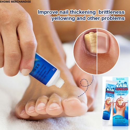 Best Fungal Nail Infection Treatment in Marathahalli Bangalore