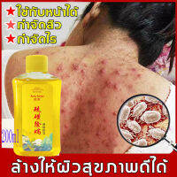 BAISHU สบู่เหลวกำมะถันกำจัดไร  ครีมอาบน้ำหอมๆ 200ml ชะล้างแบคทีเรียและไร ป้องกันเกิดสิวผิวมัน ปรับผิวใส รูขุมขน สบู่ซัลเฟอร์ สบู่ซัลเฟอร์ลดแบคทีเรีย กระชับ หอมน่าหลงไหล กลิ่นหอมนาน （สบู่เหลว เจลอาบน้ำ ครีมอาบน้ำ  สบู่อาบน้ำ  ครีมอาบน้ำกำจัดไร เจลอาบนํ้า ）