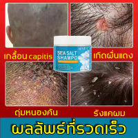 ?Hot item?ALIVER แชมพูเกลือทะเล แชมพูขจัดรังแค240มล ป้องกันรังแคและอาการคัน ควบคุมความมันและไรฝุ่น(เกลือทะเล แซมพูขจัดรังแค เกลือทะเลสระผม ยาสระผมรังแค ยาสระผมแก้เชื้อรา แชมพูรักษารังแค ยาสระผมเชื้อรา ยาสระผมแก้ผมร่วง ยารักษาเชื้อรา เชื้อราบนศีรษะ)