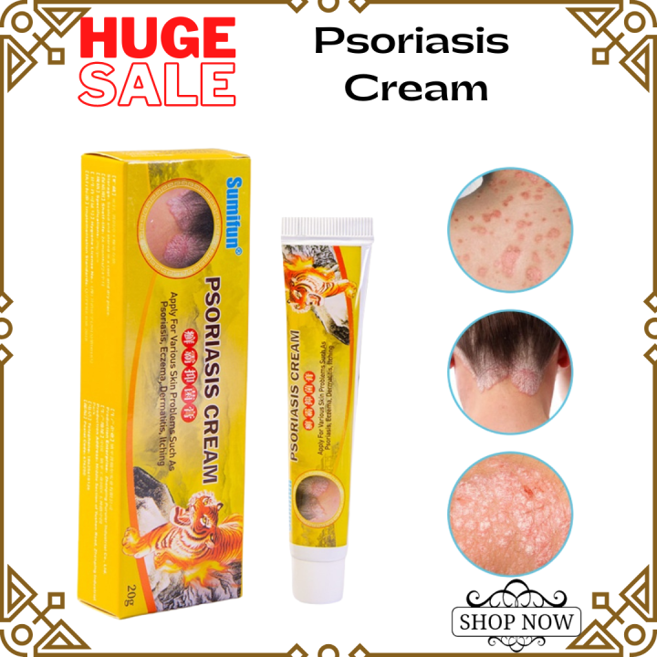 EFFECTIVE Sumifun Psoriasis Eczema Treatment Cream antibacterial cream