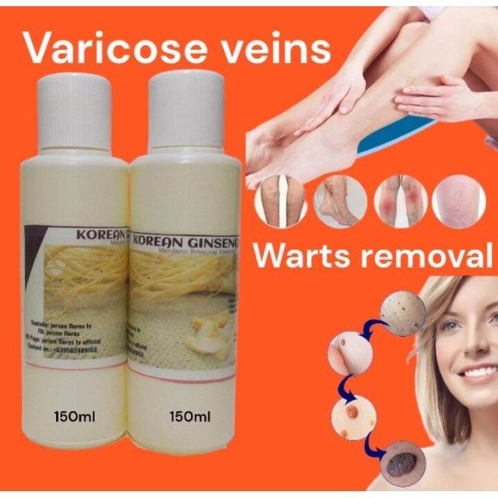 Korean ginseng oil Warts removal 150ml varicose veins pasma lamig SA