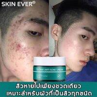 ( PRO+++ ) โปรแน่น.. SKIN EVERครีมรักษาสิว 30g ประกอบด้วยสารสกัดจากทีทรีธรรมชาติมีประสิทธิภาพในการขจัดสิวลดรอยสิวและซ่อมแซมหลุมสิว(ครีมลดสิว ราคาสุดคุ้ม ชั้น วาง ของ ชั้นวางของ ไม้ ชั้นวางของ ผนัง ชั้นวางของมินิ