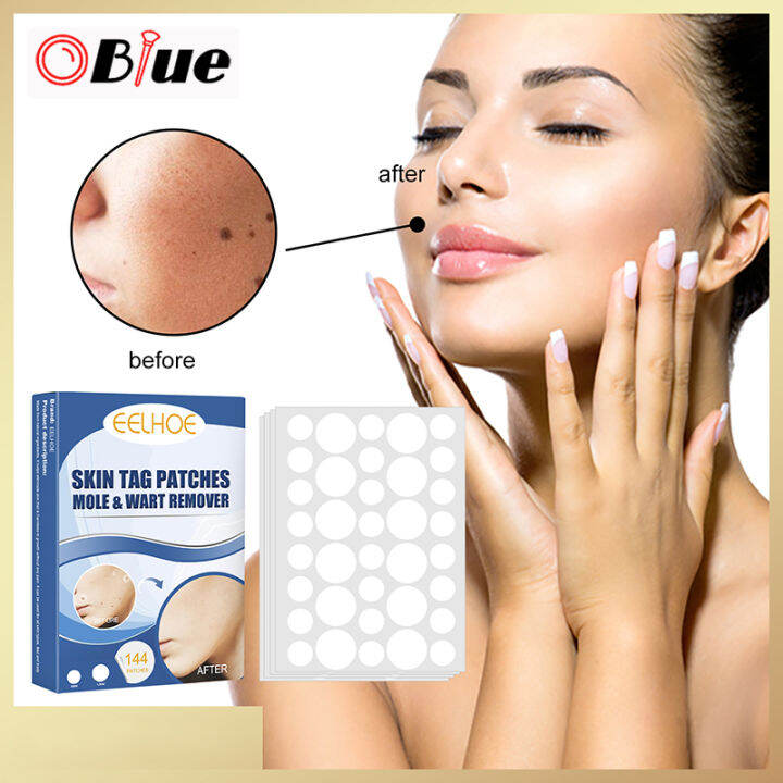 OBlue Skin Tag Patches Mole & Wart Removal Stickers for Women Men Mole