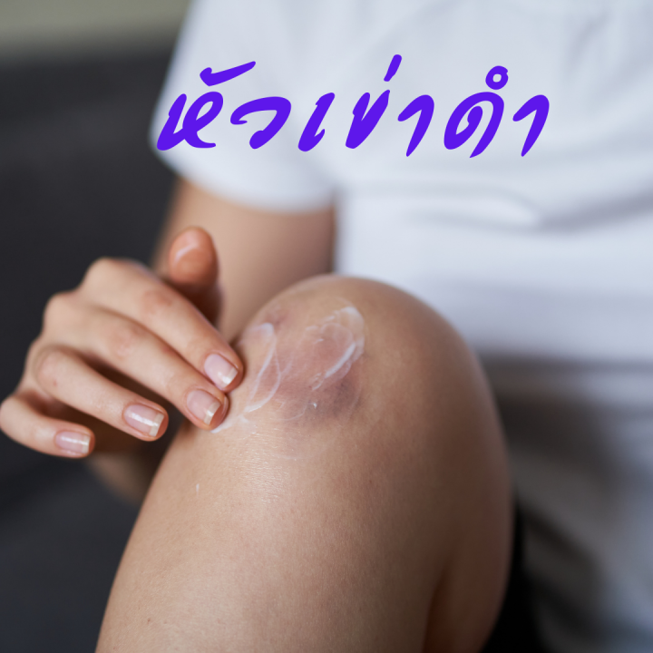 ส่งฟรี-สกิน-ซอฟเทนเนอร์-skin-softener-ครีมทาเท้าแตก-ครีมทาจุดหยาบกร้าน-ครีมทาส้นเท้า-ตาตุ่ม-หัวเข่า-ข้อศอก-และผิวสัมผัสกร้าน-ขนาด-85-g