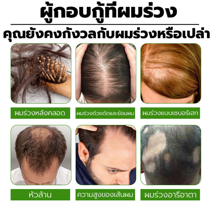 งอกเส้นผมได้อย่างรวดเร็ว-jaysuing-เซรั่มปลูกผม-ป้องกันผมร่วง-บอกลาศีรษะล้านและผมร่วง-น้ำยาปลูกผม-นีโอแฮร์ของแท้-น้ำยาเร่งผมยาว-สเปรย์ปลูกผม-ยาปลูกผมของแท้-เซรั่มบำรุงผม-ปลูกผมเร่งด่วน-น้ำยาปลูกผมชาย-น