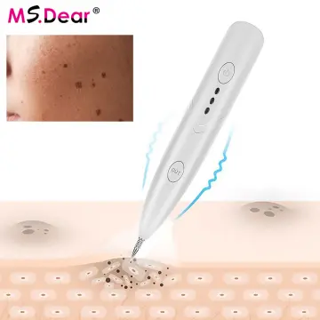 Portable Cautery Spot Pen Mole Warts Freckle Tattoo Skin Tag Remover USB  Charge