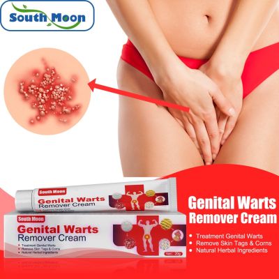 South Moon Painless Effective Wart Remover Cream Ointment Scar-Free Compound for Face Body Skin Care Fast Acting Warts M