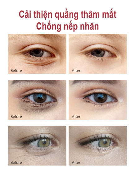 Vibrant glamour kem mắt vg retinol giảm quầng thâm mắt bọng mắt dưỡng ẩm - ảnh sản phẩm 7