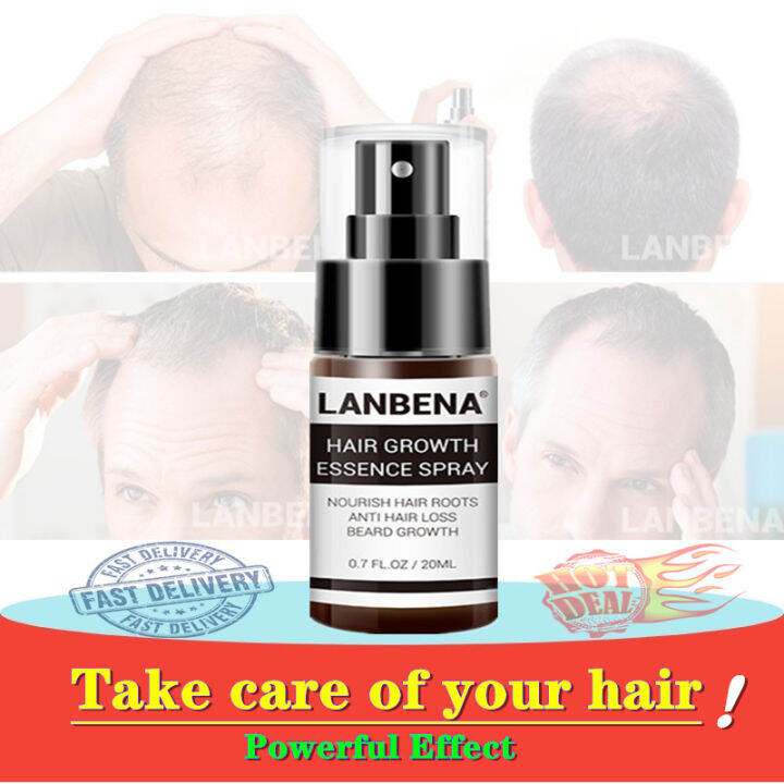 LANBENA Hair Growth Essence Spray Hair Tonic Beard Growth Hair Damage