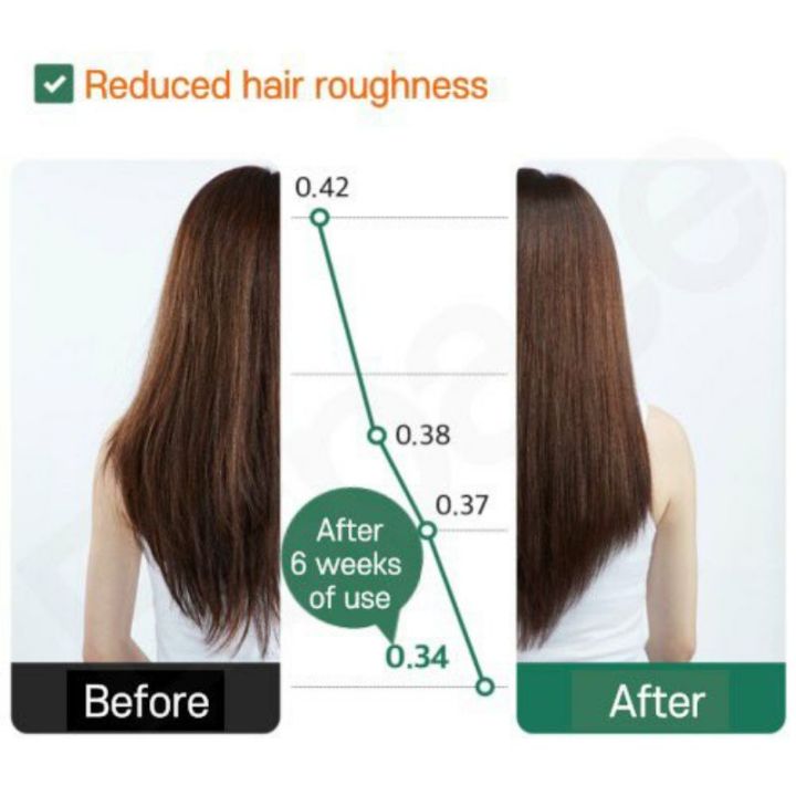 แชมพู-เกาหลี-ลดผมร่วง-labo-h-hair-loss-relief-shampoo-180ml-ลดรังแค-เกาหลี-laboh-ลดผมร่วงหัวล้าน-แก้ปัญหาหนังศีรษะ