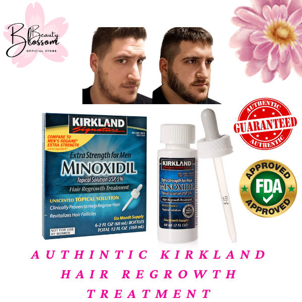 ON-HAND ORIGINAL Kirkland Minoxidil Hair Regrowth Treatment Clinically ...