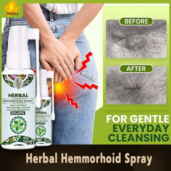 Hemmorhoid Spray Hemmoriod Ointment Almoranas Remover Hemorrhoids Miracle Ointment Hemorrhoids 6352