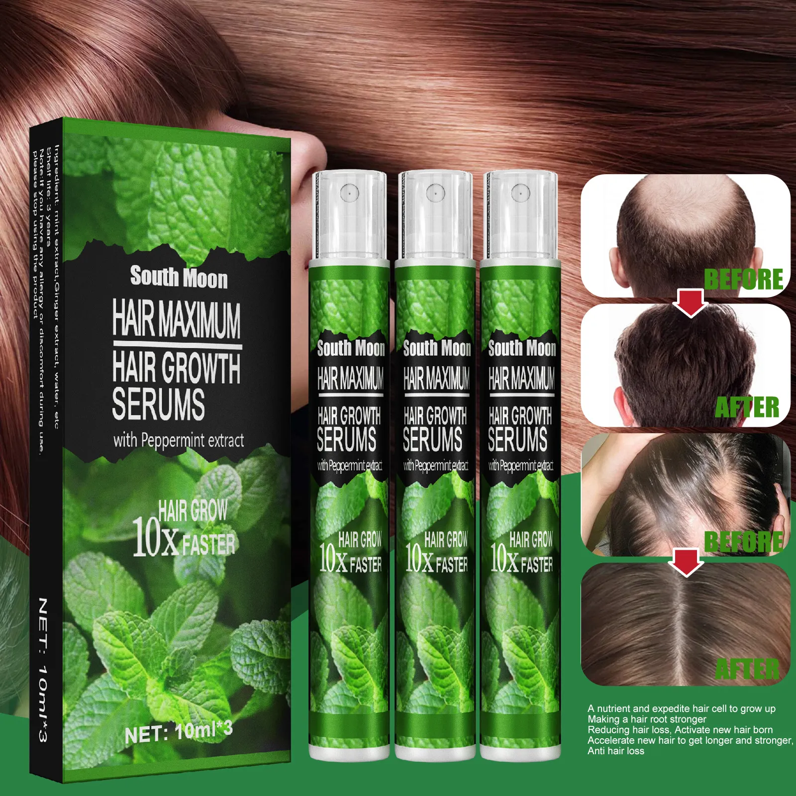 Fast DeliveryAnti-hair Loss, Fast and Powerful Hair Growth Conditioner, Hair  Growth Oil 100% Natural Treatment for Hair Loss, Promote Hair Growth for  Men and Women, Mint Hair Growth Spray, Hair Growth Essence,