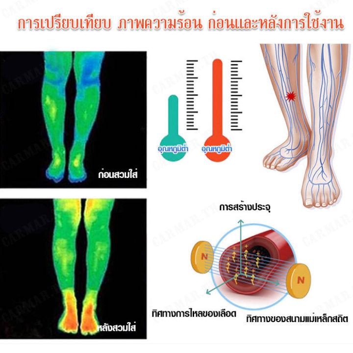 carmar-นักกีฬาชายหญิง-อุปกรณ์ป้องกันช่วยเหลือการบาดเจ็บข้อเท้า