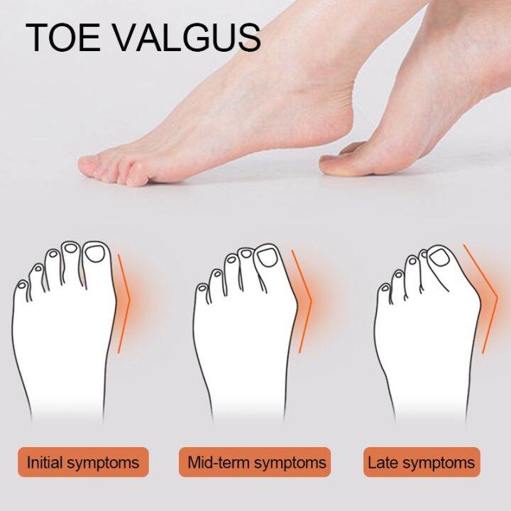 2pcs-5-holes-soft-silicone-gel-toe-separators-hallux-valgus-orthopedic-protector-thumb-corrector-spacers-bunion-relief-foot-care