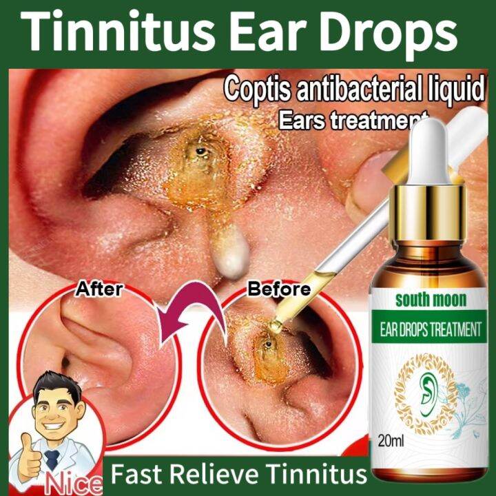 Tinnitus Ear Drops 20ML Tinnitus Treatment Relieves Tinnitus Relieves