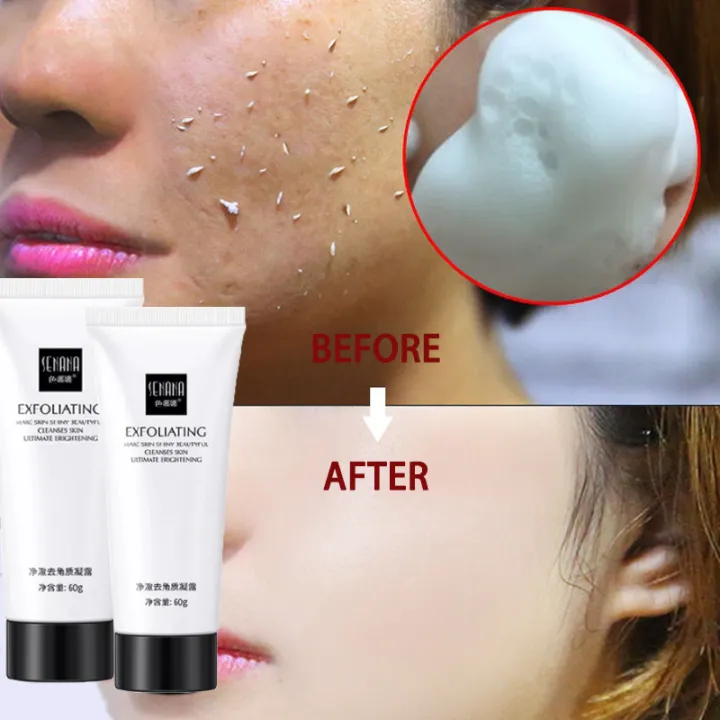 Very Effective SENANA Original Face Exfoliating Gel Aloe Vera Facial