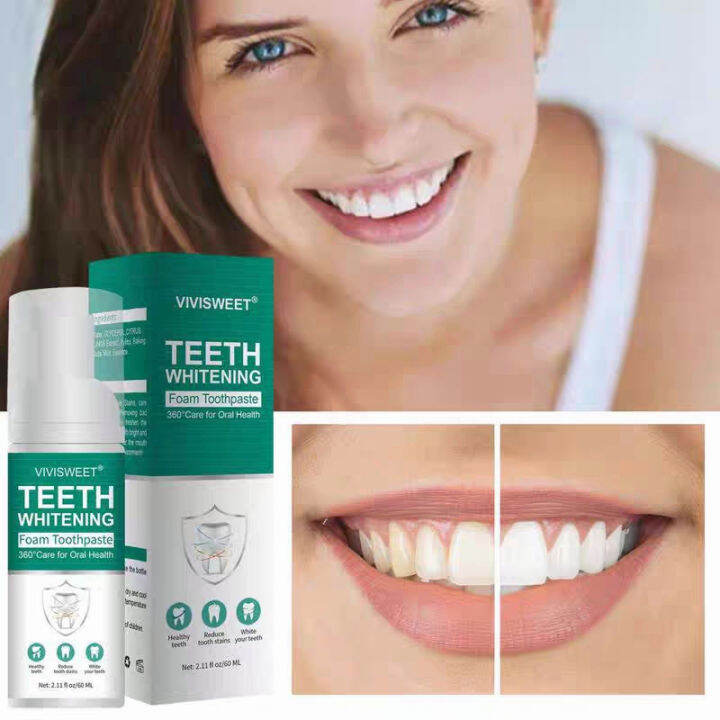 ALIVER TEETH Whitening Mousse Toothpaste Cleansing Teeth Mousse Remove ...