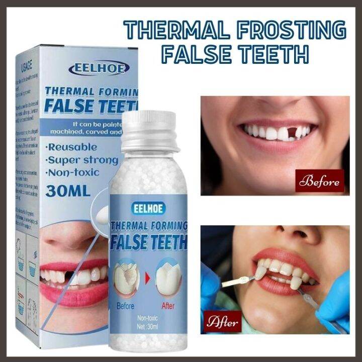 NEW BEST SELLER!! Eelhoe Thermal Frosting False Teeth Repair Missing