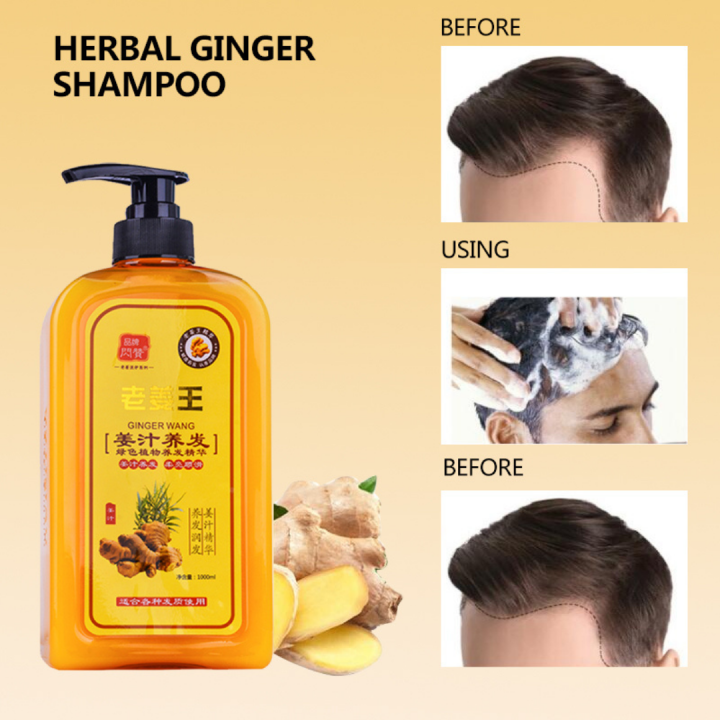 GINGER HAIR REGROWTH SHAMPOO 1000ml Antihair Loss Promotes Thicker