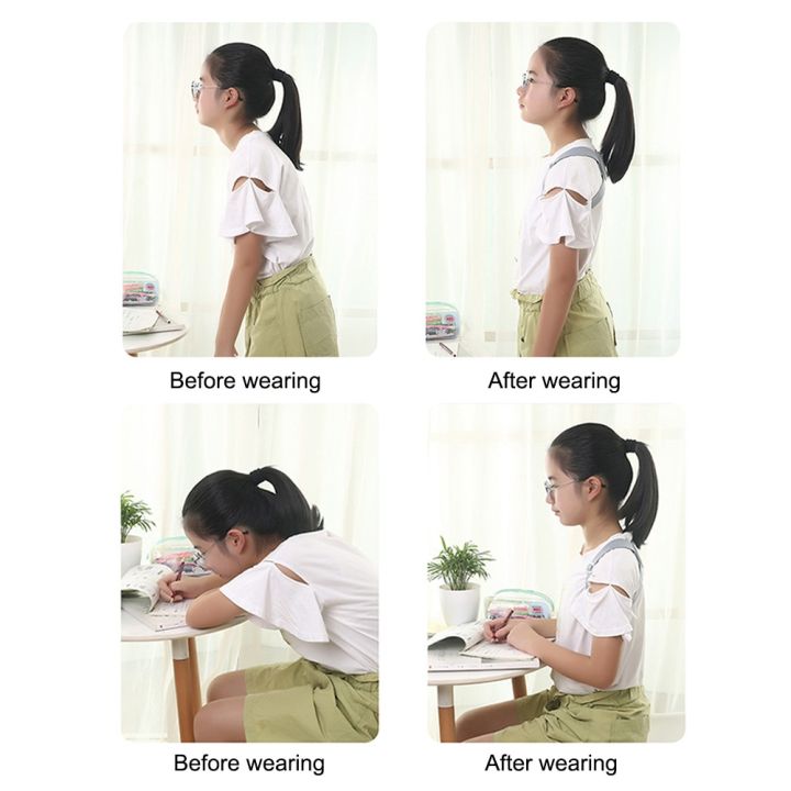 accessories-health-care-battery-operated-adjustable-strap-vibration-reminder-intelligent-sensor-posture-corrector-back-support