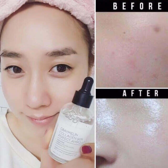 เซรั่มบำรุงผิว-graymelin-collagen-90-perfect-ampoule-50ml-เซรั่มเกาหลี-คอลลาเจนเข้มข้น-90-บำรุงผิวเนียนกระชับเด้งเหมือนผิวเด็ก-สินค้าพร้อมส่ง