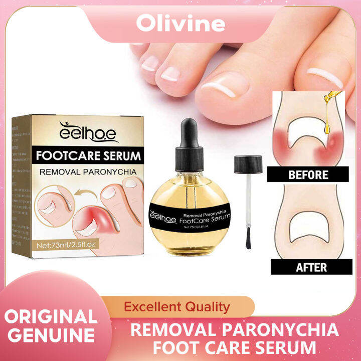 Eelhoe Removal Paronychia Foot Care Serum Anti Nail Groove Essence ...