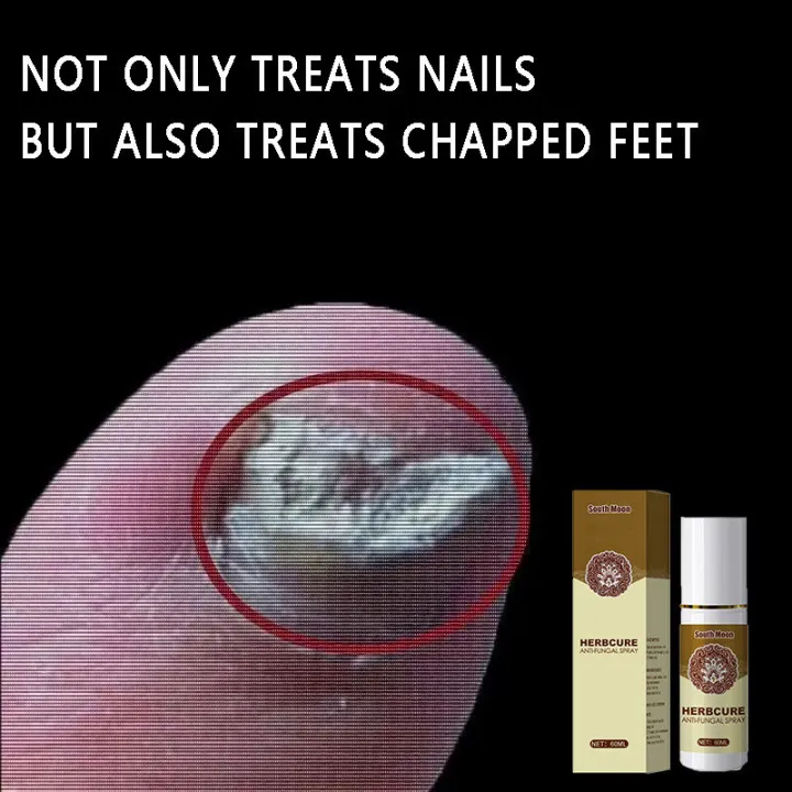 【Support COD】callus remover calluses foot remover cracked heel remover