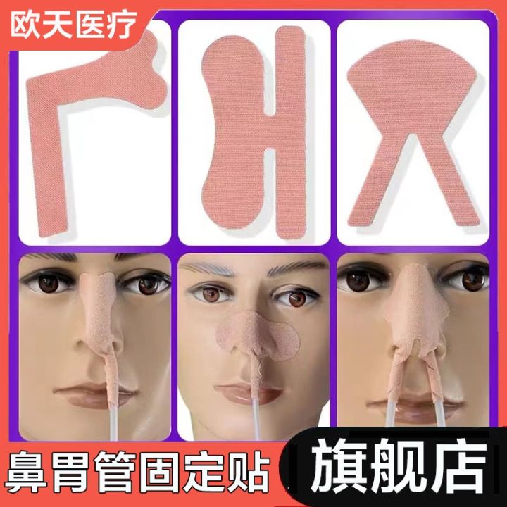 Outian medical catheter fixed paste nose bridge paste gastric tube ...