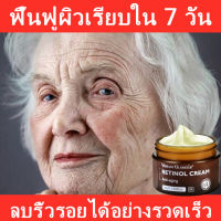 ครีมเรตินอลแท้ ครีมลดริ้วรอย ครีมบำรุงหน้า retinol cream ครีมหน้าเด้งใส ครีมยกกระชับ ครีมลบริ้วรอย ครีมทาหน้าขาว เรตินอลครีมแท้ ลดริ้วรอย