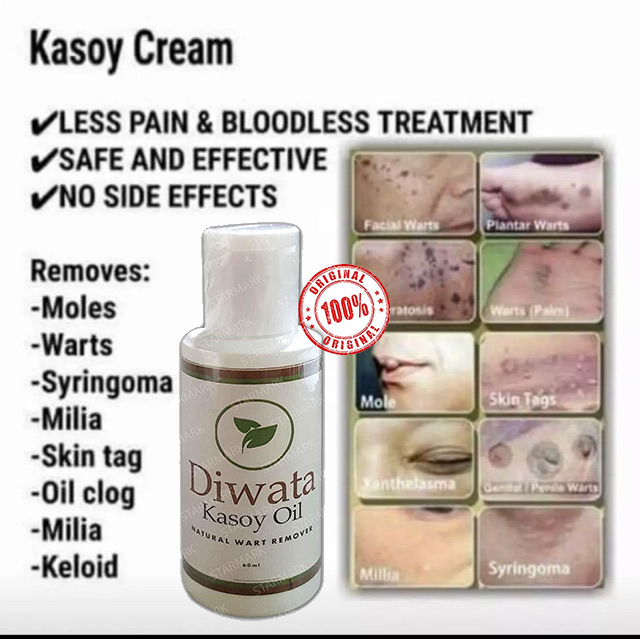 Beauty Rise Authentic Diwata Kasoy Oil Natural Wart Remover 60ml warts ...